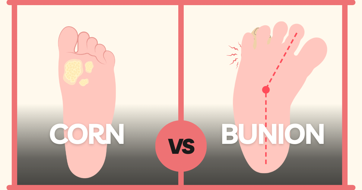 What Is The Difference Between A Corn And A Bunion An Insight Lifebing