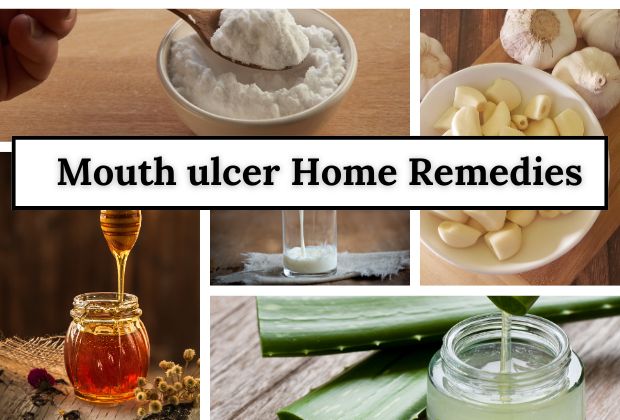 snap of different types of home remedies for mouth sores.