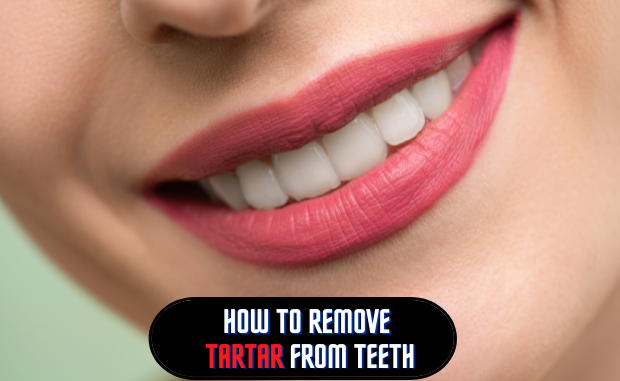 How to remove tartar from teeth